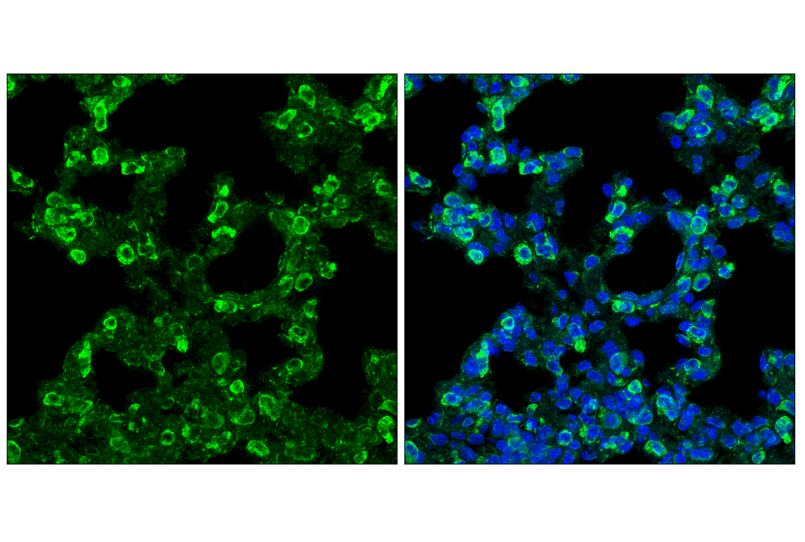 Immunofluorescence Image 2: PDI (C81H6) Rabbit Monoclonal Antibody (BSA and Azide Free)