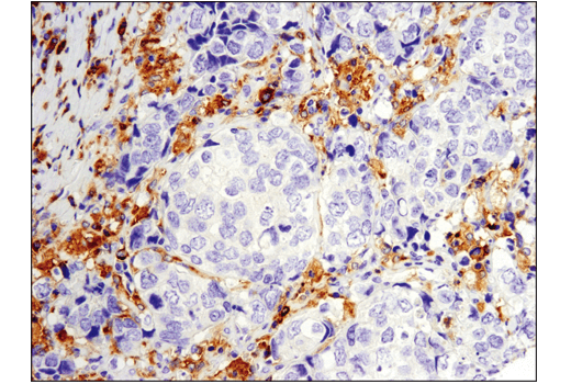 Immunohistochemistry Image 1: Btk (D3H5) Rabbit Monoclonal Antibody (BSA and Azide Free)
