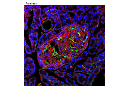 Immunofluorescence Image 1: VEGF Receptor 2 (D5B1) Rabbit mAb (BSA and Azide Free)