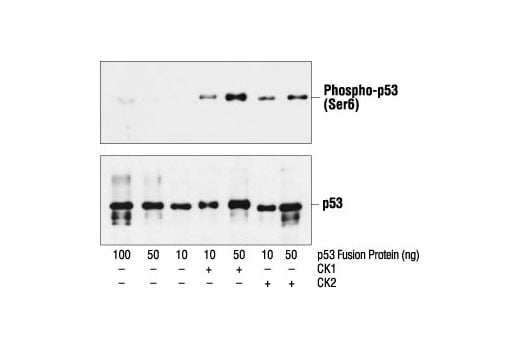 undefined Image 14: Phospho-p53 Antibody Sampler Kit