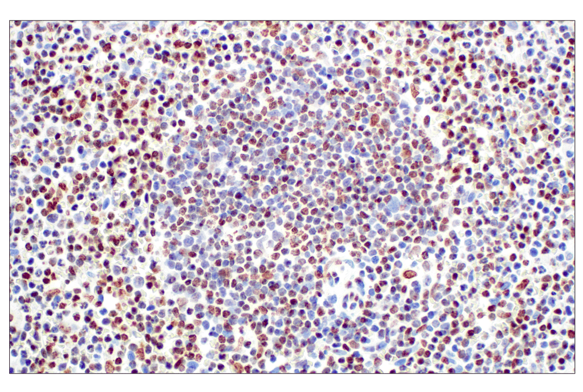 Immunohistochemistry Image 5: Tri-Methyl-Histone H3 (Lys27) (C36B11) Rabbit Monoclonal Antibody