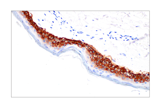 Immunohistochemistry Image 4: Keratin 14 (LL002) Mouse Monoclonal Antibody