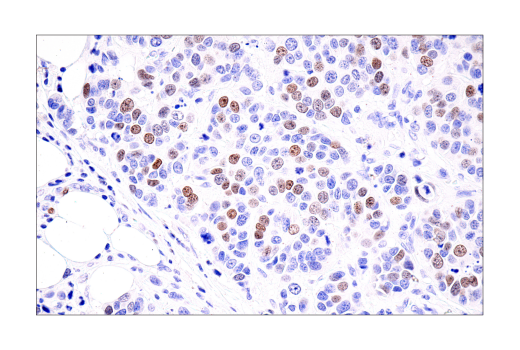 Immunohistochemistry Image 4: ATAD2 (E8Y7F) Rabbit Monoclonal Antibody