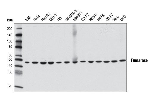 Western Blotting Image 2: Fumarase (D9C5) Rabbit Monoclonal Antibody