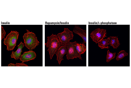 Immunofluorescence Image 1: Phospho-CAD (Ser1859) (D5O6C) Rabbit Monoclonal Antibody