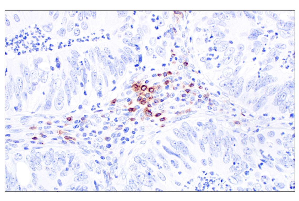 Immunohistochemistry Image 4: CCR4 (F9A9K) Rabbit Monoclonal Antibody
