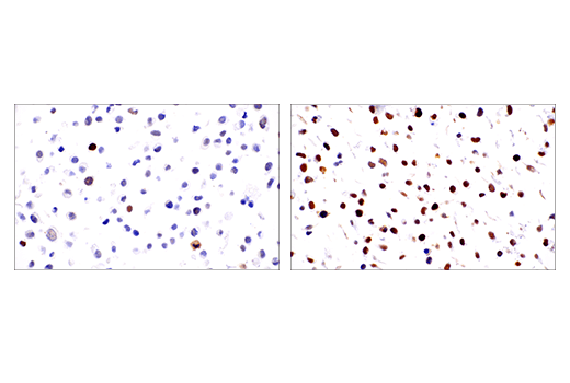 Immunohistochemistry Image 1: Phospho-Chk2 (Thr68) (E8Q1A) Rabbit Monoclonal Antibody (BSA and Azide Free)