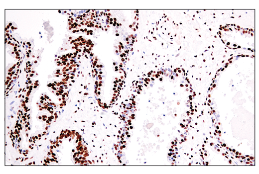 Immunohistochemistry Image 6: ADAR1 (E6X9R) Rabbit Monoclonal Antibody