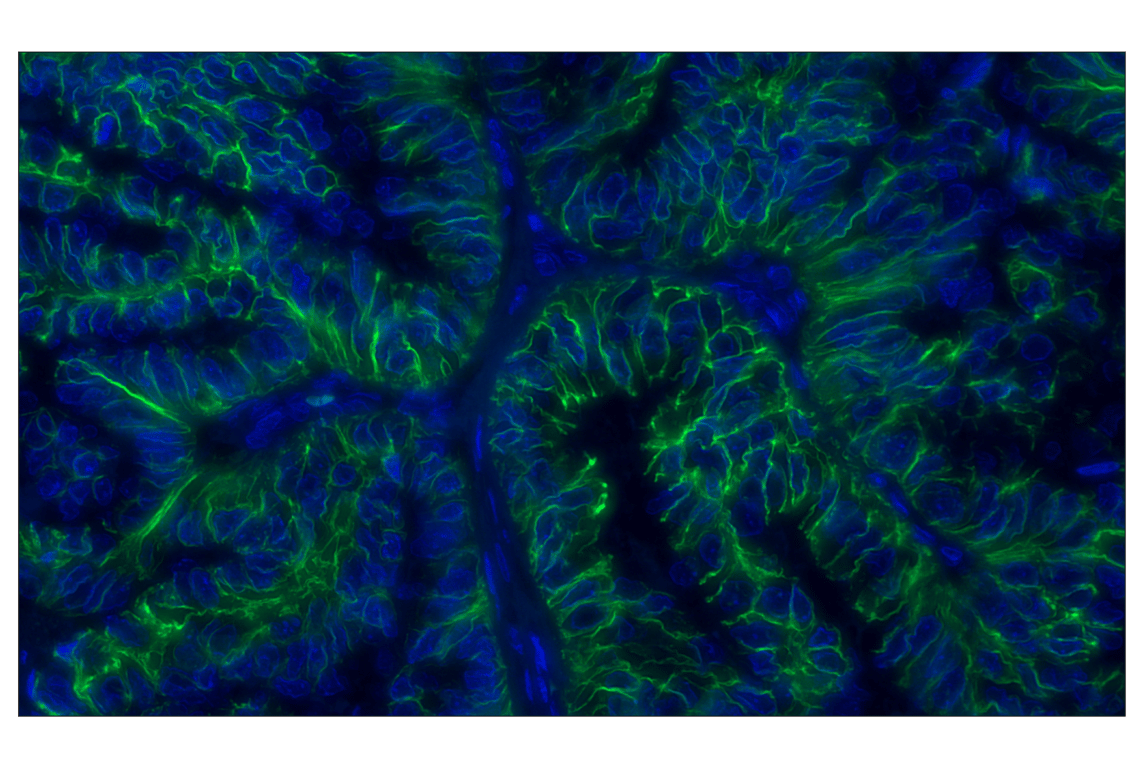 Immunohistochemistry Image 3: NCAM1 (CD56) (E7X9M) Rabbit Monoclonal Antibody (Alexa Fluor<sup>®</sup> 488 Conjugate)