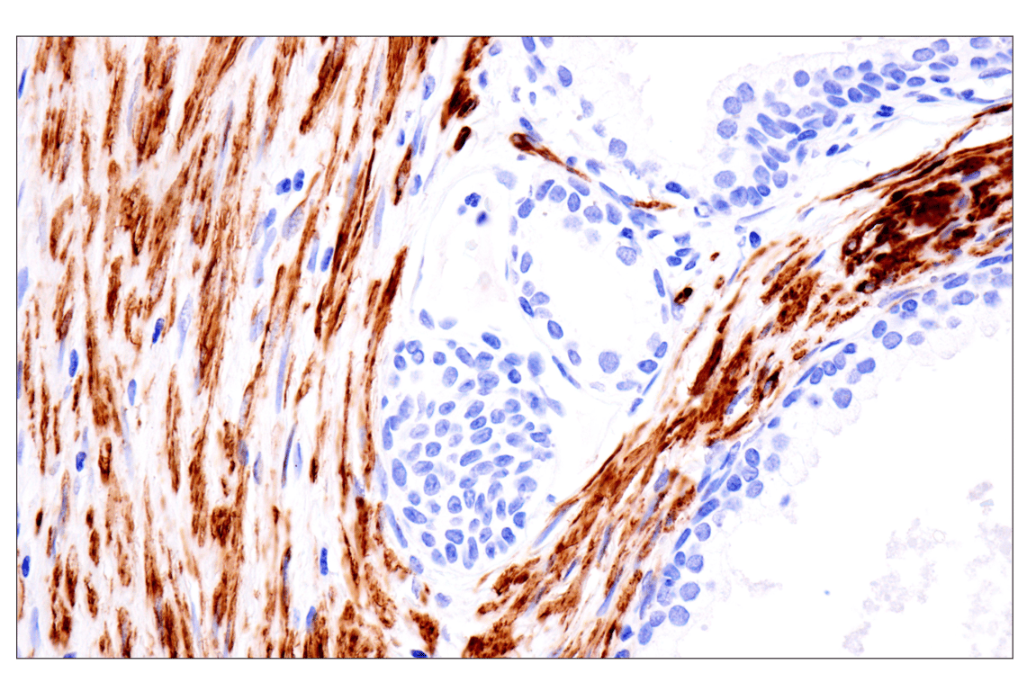 Immunohistochemistry Image 2: Desmin (F5V4I) Rabbit Monoclonal Antibody