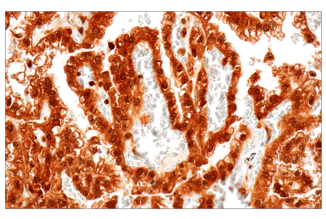 Immunohistochemistry Image 1: MTAP (E5R1I) Rabbit Monoclonal Antibody