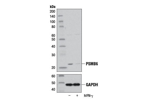 Western Blotting Image 2: PSMB6 (E1K9O) Rabbit Monoclonal Antibody