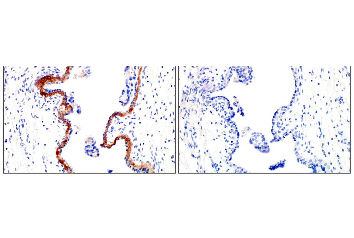Immunohistochemistry Image 8: OLR1/LOX1 (E9C5A) Rabbit Monoclonal Antibody