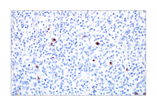 Immunohistochemistry Image 2: CD57 (HNK-1) Mouse Monoclonal Antibody