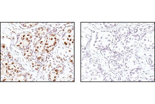 Immunohistochemistry Image 2: Phospho-Threonine-Proline Mouse Monoclonal Antibody (P-Thr-Pro-101)