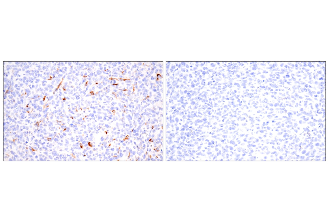 Immunohistochemistry Image 7: Cathepsin K (E7U5N) Rabbit Monoclonal Antibody (BSA and Azide Free)