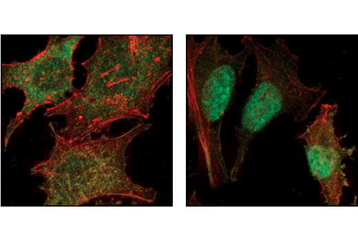 Immunofluorescence Image 1: SMAD2 (86F7) Rabbit Monoclonal Antibody