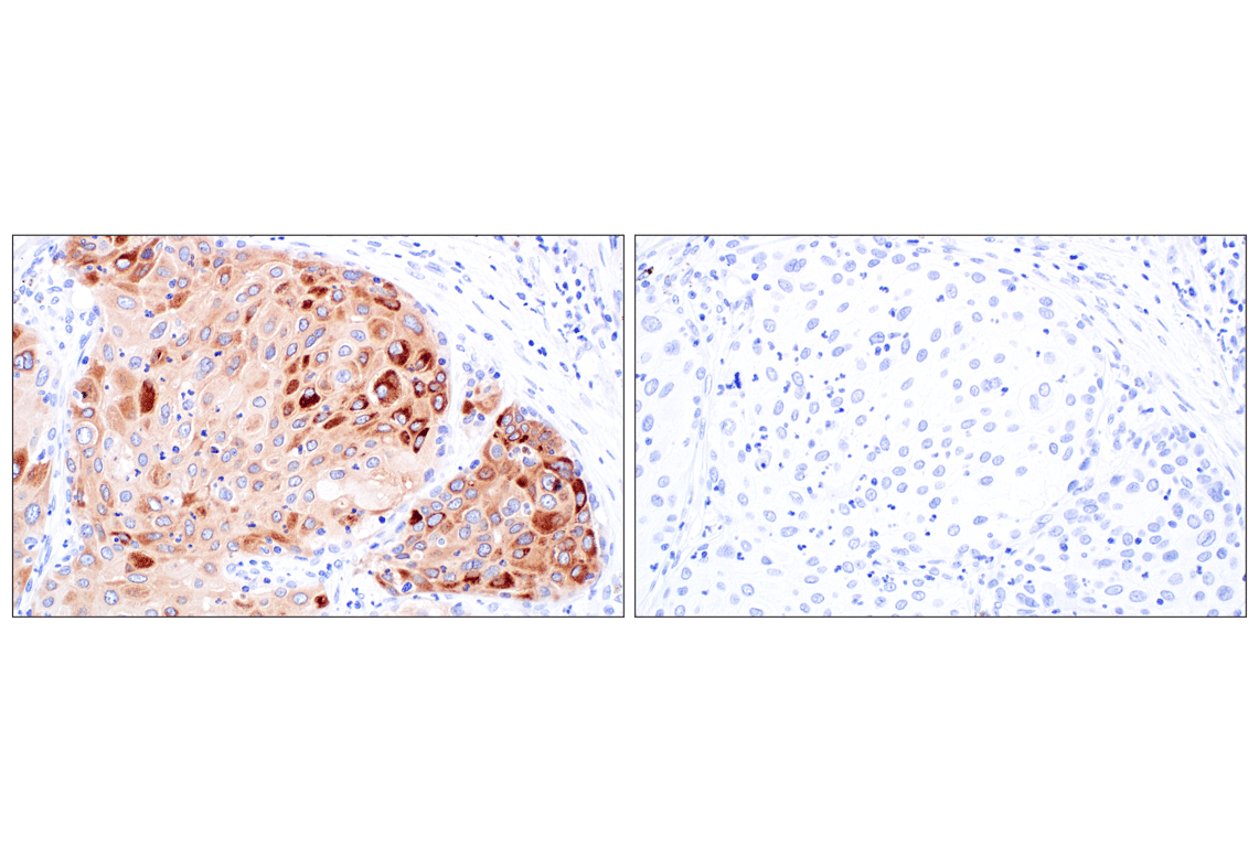 Immunohistochemistry Image 9: IGFBP2 (F3E6V) Rabbit Monoclonal Antibody