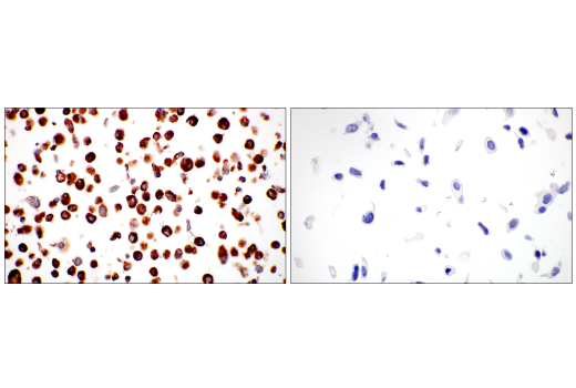 Immunohistochemistry Image 10: COL14A1 (E5W8S) Rabbit Monoclonal Antibody (BSA and Azide Free)