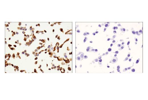 Immunohistochemistry Image 6: VISTA (D1L2G) Rabbit Monoclonal Antibody (BSA and Azide Free)