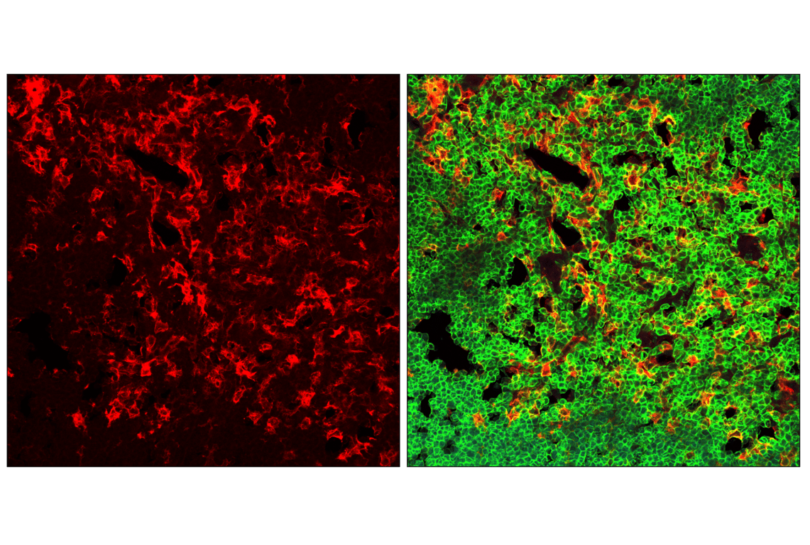 Immunofluorescence Image 1: CD11c (D1V9Y) Rabbit Monoclonal Antibody (Alexa Fluor<sup>®</sup> 555 Conjugate)