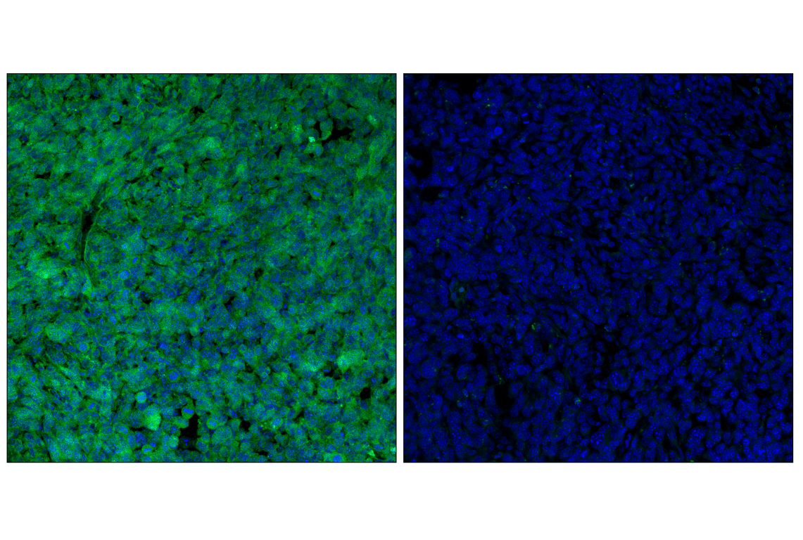 Immunofluorescence Image 1: p16 INK4A (F2T7H) Rabbit Monoclonal Antibody