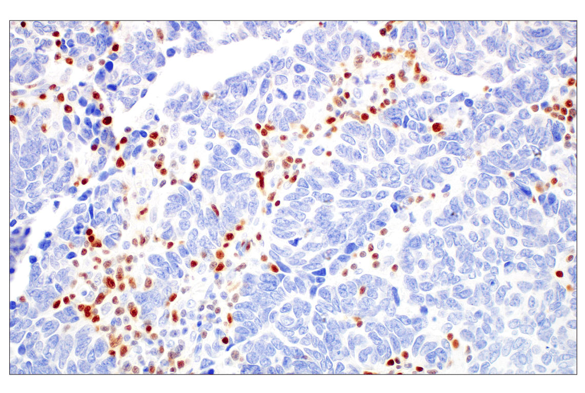 Immunohistochemistry Image 4: T-bet/TBX21 (E4I2K) Rabbit Monoclonal Antibody (BSA and Azide Free)