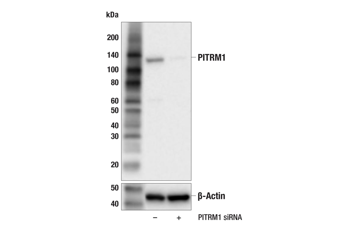 Western Blotting Image 2: PITRM1 (F2Y2T) Rabbit Monoclonal Antibody
