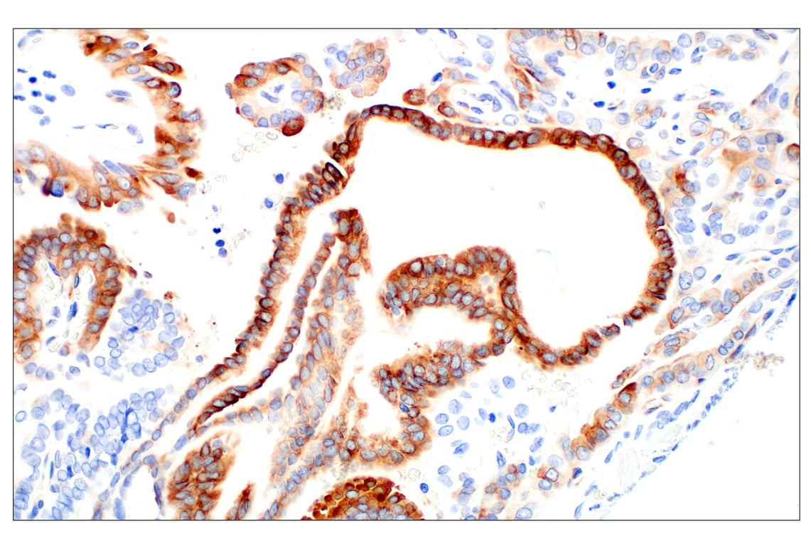 Immunohistochemistry Image 6: beta3-Tubulin (E9F3E) Mouse Monoclonal Antibody