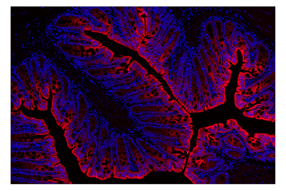 Pan-Keratin MultiMab® Rabbit Monoclonal Antibody mix (Alexa Fluor