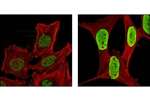 Immunofluorescence Image 1: Acetyl-Histone H4 (Lys12) Antibody