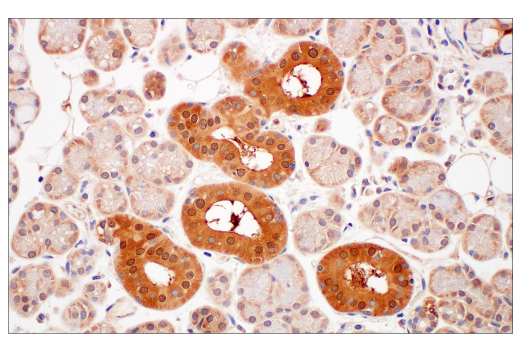 undefined Image 25: Gluconeogenesis Antibody Sampler Kit