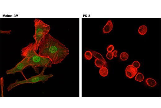 Immunofluorescence Image 1: Stat5 (D3N2B) Rabbit Monoclonal Antibody