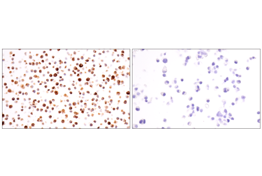 Immunohistochemistry Image 6: Osteopontin/SPP1 (E9Z1D) Rabbit Monoclonal Antibody