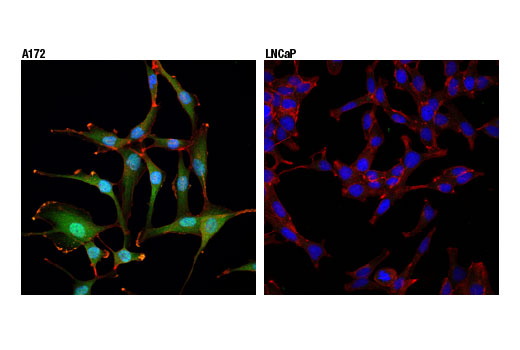 undefined Image 14: Microglia Interferon-Related Module Antibody Sampler Kit