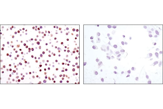 Immunohistochemistry Image 4: NFAT1 (D43B1) Rabbit Monoclonal Antibody