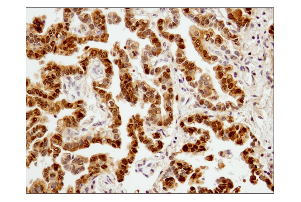 undefined Image 32: Stat Antibody Sampler Kit II