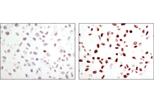 undefined Image 14: Phospho-SAPK/JNK Pathway Antibody Sampler Kit