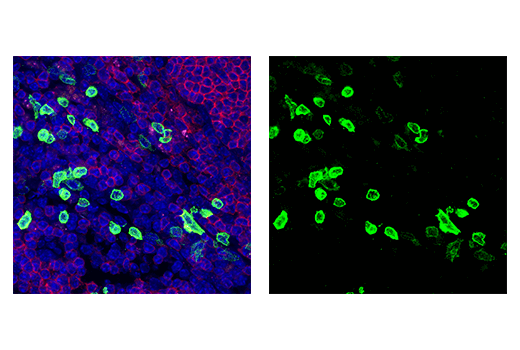 Immunofluorescence Image 1: NK1.1/CD161 (E6Y9G) Rabbit Monoclonal Antibody