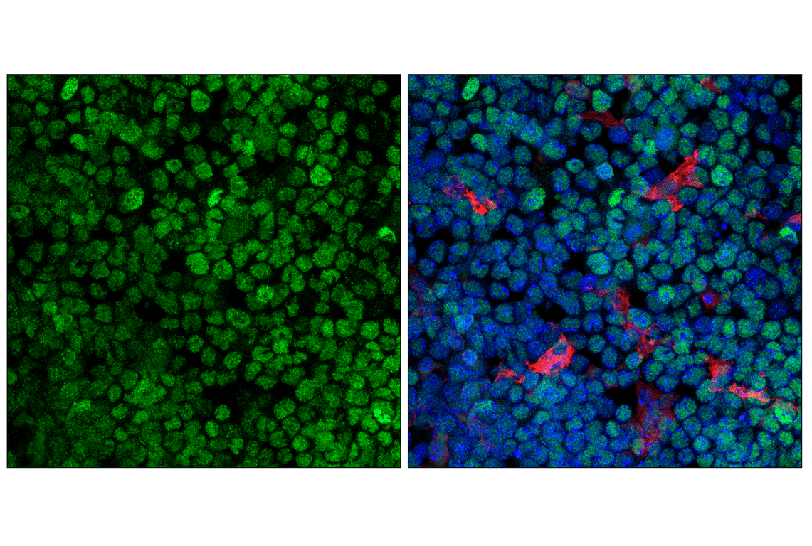 Immunofluorescence Image 1: HIF-1 alpha (E1V6A) Rabbit Monoclonal Antibody