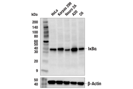 Western Blotting Image 2: IkappaB alpha Antibody