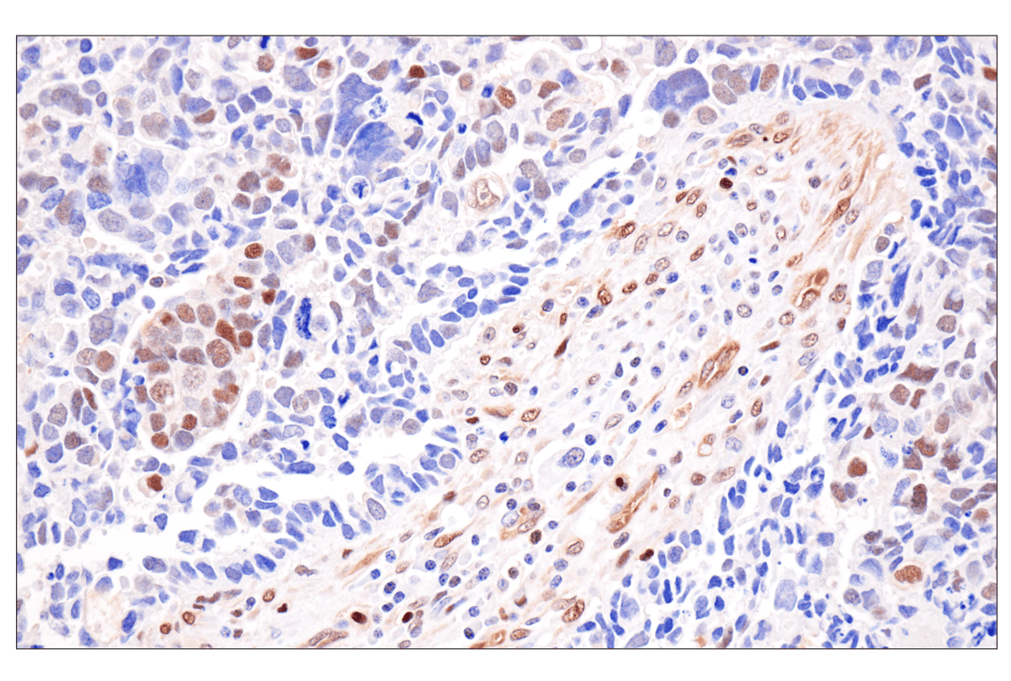 Immunohistochemistry Image 3: Phospho-ATP-Citrate Lyase (Ser455) (F4T8R) Rabbit Monoclonal Antibody