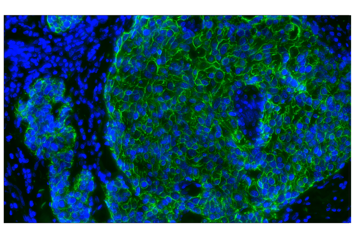 Immunohistochemistry Image 1: E-Cadherin (24E10) Rabbit mAb (Alexa Fluor<sup>®</sup> 488 Conjugate)