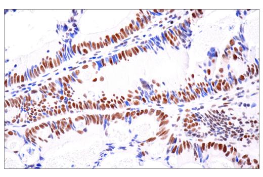 Immunohistochemistry Image 2: ATRX (E5X7O) Rabbit Monoclonal Antibody