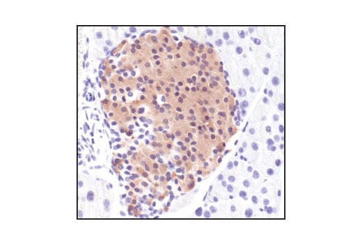 Immunohistochemistry Image 2: Insulin Antibody