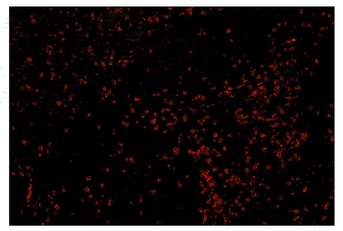 Immunohistochemistry Image 4: CD8 alpha (D8A8Y) & CO-0004-594 SignalStar<sup>™</sup> Oligo-Antibody Pair