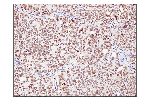 Immunohistochemistry Image 3: SS18 (D6I4Z) Rabbit Monoclonal Antibody (BSA and Azide Free)