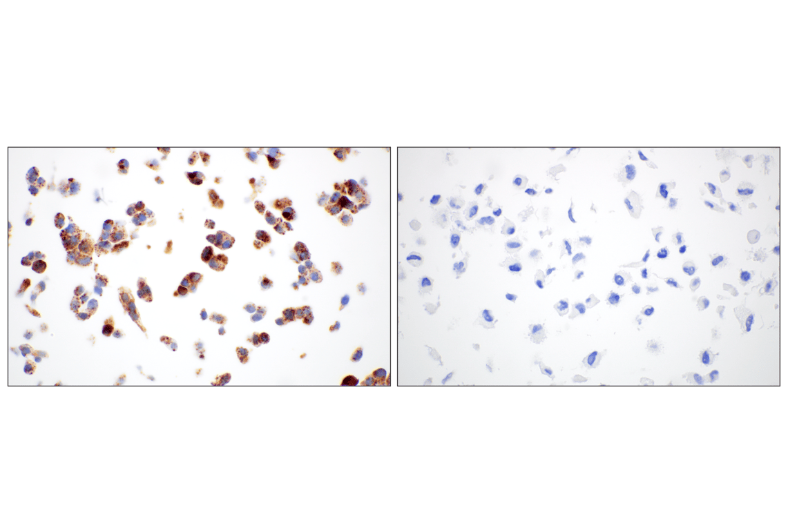 Immunohistochemistry Image 16: Perilipin-2 (E6G6M) Rabbit Monoclonal Antibody