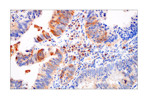 Immunohistochemistry Image 3: Asparagine Synthetase (E6C2C) Rabbit Monoclonal Antibody (BSA and Azide Free)