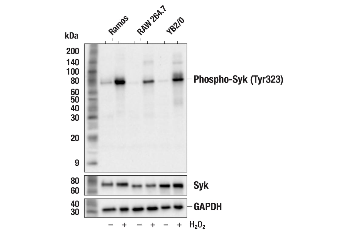 Western Blotting Image 2: Phospho-Syk (Tyr323) (F9H7U) Rabbit Monoclonal Antibody